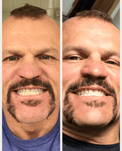 Load image into Gallery viewer, GRONK's Snow® Teeth Whitening At-Home System [All-in-One Kit]
